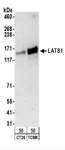 LATS1 Antibody - Detection of Mouse LATS1 by Western Blot. Samples: Whole cell lysate (50 ug) from CT26.WT and TCMK-1 cells. Antibodies: Affinity purified rabbit anti-LATS1 antibody used for WB at 0.2 ug/ml. Detection: Chemiluminescence with an exposure time of 3 minutes.