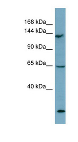 LATS1 Antibody - LATS1 antibody Western blot of THP-1 cell lysate. This image was taken for the unconjugated form of this product. Other forms have not been tested.
