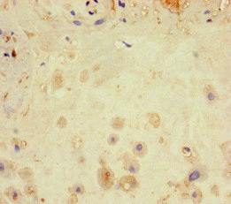 LATS1 Antibody - Immunohistochemistry of paraffin-embedded human placenta tissue at dilution of 1:100