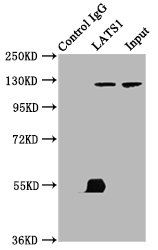 LATS1 Antibody - Immunoprecipitating LATS1 in K562 whole cell lysate Lane 1: Rabbit control IgG (1µg) instead of product in K562 whole cell lysate.For western blotting,a HRP-conjugated Protein G antibody was used as the Secondary antibody (1/2000) Lane 2: product (6µg) + K562 whole cell lysate (500µg) Lane 3: K562 whole cell lysate (10µg)