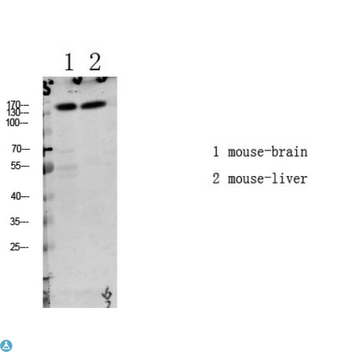 LATS1 Antibody - Western blot analysis of various lysate, antibody was diluted at 1000. Secondary antibody was diluted at 1: 20000.