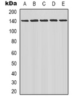 LATS1 + LATS2 Antibody - Western blot analysis of LATS1/2 expression in K562 (A); HeLa (B); HEK293T (C); mouse lung (D); rat muscle (E) whole cell lysates.
