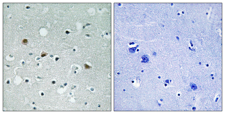LATS1 + LATS2 Antibody - Immunohistochemistry analysis of paraffin-embedded human brain, using LATS1/2 (Phospho-Thr1079/1041) Antibody. The picture on the right is blocked with the phospho peptide.