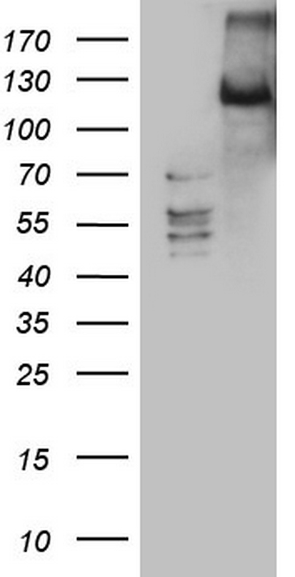 LATS2 Antibody - HEK293T cells were transfected with the pCMV6-ENTRY control (Left lane) or pCMV6-ENTRY LATS2 (Right lane) cDNA for 48 hrs and lysed. Equivalent amounts of cell lysates (5 ug per lane) were separated by SDS-PAGE and immunoblotted with anti-LATS2.