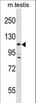 LATS2 Antibody - Mouse Lats2 Antibody western blot of mouse testis tissue lysates (35 ug/lane). The Mouse Lats2 antibody detected the Mouse Lats2 protein (arrow).