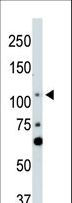 LATS2 Antibody - The anti-LATS2 antibody is used in Western blot to detect LATS2 in NIH-3T3 cell lysate.