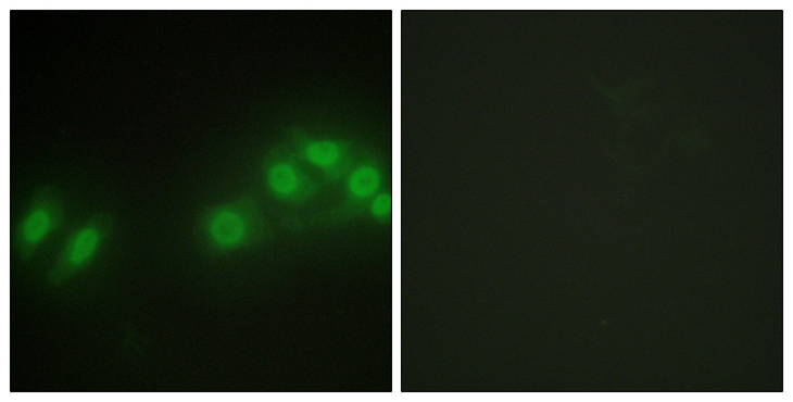 LATS2 Antibody - Immunofluorescence analysis of HepG2 cells, using LATS2 Antibody. The picture on the right is blocked with the synthesized peptide.