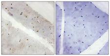 LATS2 Antibody - Immunohistochemistry analysis of paraffin-embedded human skeletal muscle tissue, using LATS2 Antibody. The picture on the right is blocked with the synthesized peptide.