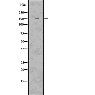 LATS2 Antibody - Western blot analysis of lats2 using HepG2 whole cells lysates