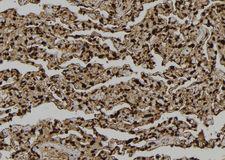 LATS2 Antibody - 1:100 staining human lung tissue by IHC-P. The sample was formaldehyde fixed and a heat mediated antigen retrieval step in citrate buffer was performed. The sample was then blocked and incubated with the antibody for 1.5 hours at 22°C. An HRP conjugated goat anti-rabbit antibody was used as the secondary.
