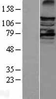 LATS2 Protein - Western validation with an anti-DDK antibody * L: Control HEK293 lysate R: Over-expression lysate