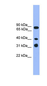LAX1 / LAX Antibody - LAX1 antibody Western blot of Jurkat lysate. This image was taken for the unconjugated form of this product. Other forms have not been tested.