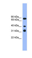 LAX1 / LAX Antibody - LAX1 antibody Western blot of Jurkat lysate. This image was taken for the unconjugated form of this product. Other forms have not been tested.