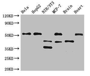 LAX1 / LAX Antibody - Positive WB detected in:Hela whole cell lysate,HepG2 whole cell lysate,NIH/3T3 whole cell lysate,MCF-7 whole cell lysate,Mouse brain tissue,Rat heart tissue;All lanes:LAX1 antibody at 2.7?g/ml;Secondary;Goat polyclonal to rabbit IgG at 1/50000 dilution;Predicted band size: 45,36,43 KDa;Observed band size: 51,45,36 KDa;