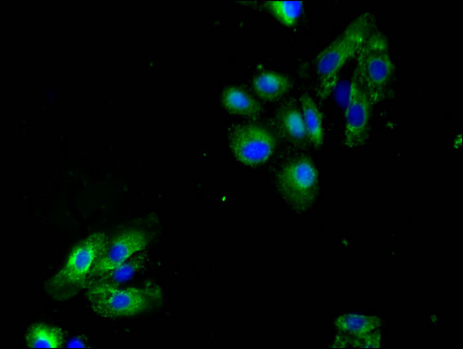 LAX1 / LAX Antibody - Immunofluorescent analysis of HepG2 cells using LAX1 Antibody at a dilution of 1:100 and Alexa Fluor 488-congugated AffiniPure Goat Anti-Rabbit IgG(H+L)