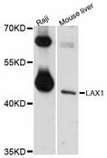 LAX1 / LAX Antibody - Western blot analysis of extracts of various cell lines, using LAX1 antibody at 1:1000 dilution. The secondary antibody used was an HRP Goat Anti-Rabbit IgG (H+L) at 1:10000 dilution. Lysates were loaded 25ug per lane and 3% nonfat dry milk in TBST was used for blocking. An ECL Kit was used for detection and the exposure time was 10s.
