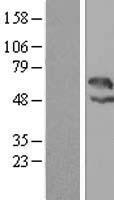 LAX1 / LAX Protein - Western validation with an anti-DDK antibody * L: Control HEK293 lysate R: Over-expression lysate