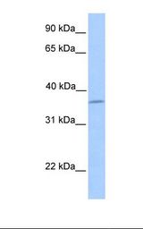 Layilin / LAYN Antibody - MCF7 cell lysate. Antibody concentration: 1.0 ug/ml. Gel concentration: 12%.  This image was taken for the unconjugated form of this product. Other forms have not been tested.