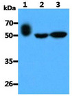 Layilin / LAYN Antibody - The Recombinant Human LAYN (25ng) and Cell lysates (40ug) were resolved by SDS-PAGE, transferred to PVDF membrane and probed with anti-human LAYN antibody (1:3000). Proteins were visualized using a goat anti-mouse secondary antibody conjugated to HRP and an ECL detection system. Lane 1.: Recombinant Human LAYN Lane 2.: A549 cell lysate Lane 3.: 293T cell lysate