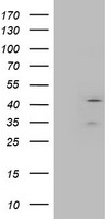 Layilin / LAYN Antibody - HEK293T cells were transfected with the pCMV6-ENTRY control (Left lane) or pCMV6-ENTRY LAYN (Right lane) cDNA for 48 hrs and lysed. Equivalent amounts of cell lysates (5 ug per lane) were separated by SDS-PAGE and immunoblotted with anti-LAYN.