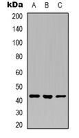 Layilin / LAYN Antibody - Western blot analysis of Layilin expression in U251 (A); K562 (B); A549 (C) whole cell lysates.