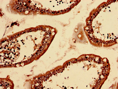 LBA / LRBA Antibody - Immunohistochemistry analysis of human small intestine tissue using LRBA Antibody at dilution of 1:100