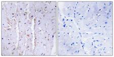 LBC / AKAP13 Antibody - Immunohistochemistry analysis of paraffin-embedded human heart tissue, using AKAP13 Antibody. The picture on the right is blocked with the synthesized peptide.