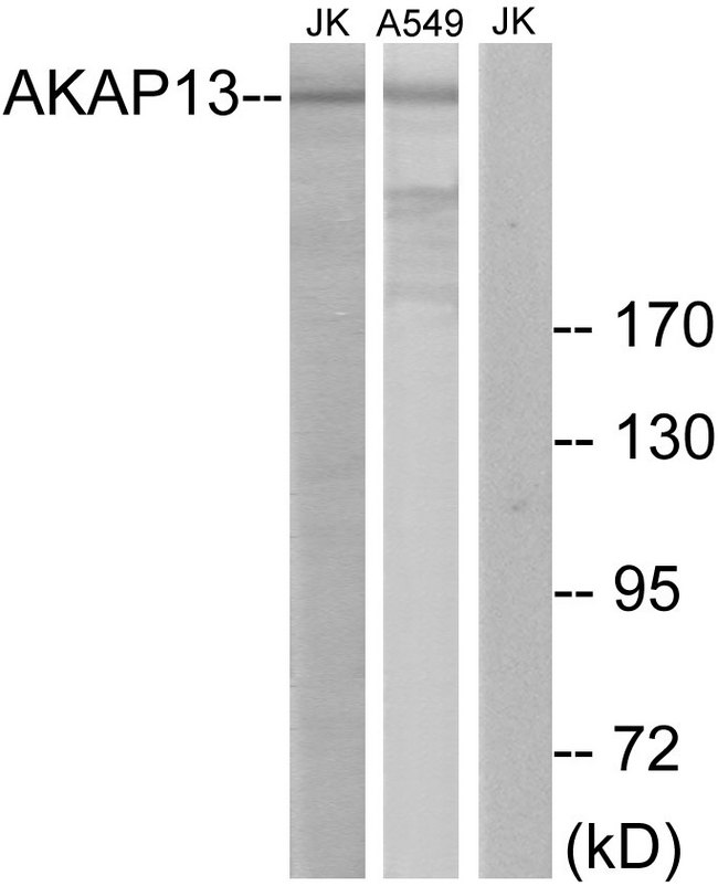 LBC / AKAP13 Antibody - Western blot analysis of lysates from Jurkat and A549 cells, using AKAP13 Antibody. The lane on the right is blocked with the synthesized peptide.
