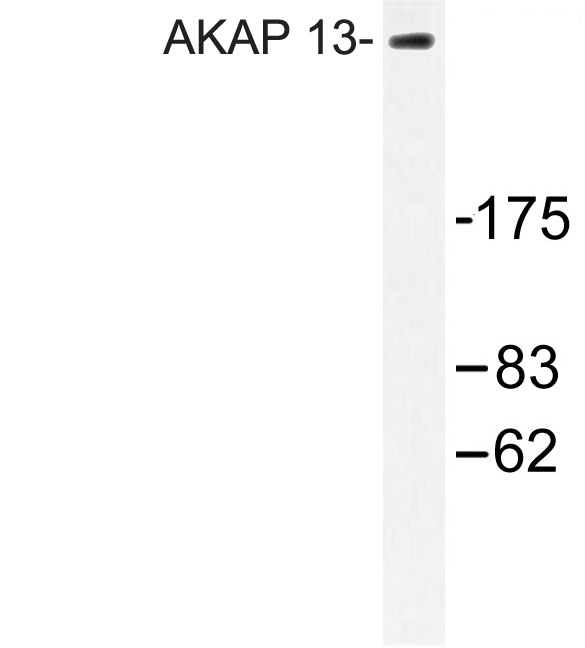 LBC / AKAP13 Antibody - Western blot of AKAP 13 (D738) pAb in extracts from Jurkat cells.