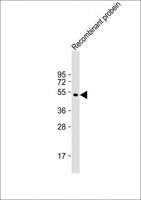LBC / AKAP13 Antibody - Anti-AKAP13 Antibody at 1:8000 dilution + Recombinant probein Lysates/proteins at 20 µg per lane. Secondary Goat Anti-mouse IgG, (H+L), Peroxidase conjugated at 1/10000 dilution. Predicted band size: 308 kDa Blocking/Dilution buffer: 5% NFDM/TBST.