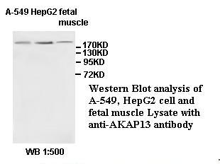 LBC / AKAP13 Antibody