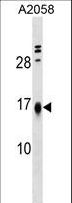 LBH Antibody - LBH Antibody western blot of A2058 cell line lysates (35 ug/lane). The LBH antibody detected the LBH protein (arrow).