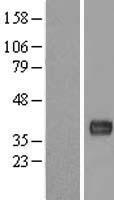 LBHD1 / C11orf48 Protein - Western validation with an anti-DDK antibody * L: Control HEK293 lysate R: Over-expression lysate