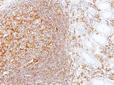 LBP Antibody - IHC of paraffin-embedded Gastric N+T using LBP antibody at 1:100 dilution.