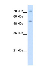 LBP Antibody - LBP antibody Western blot of HepG2 cell lysate. This image was taken for the unconjugated form of this product. Other forms have not been tested.