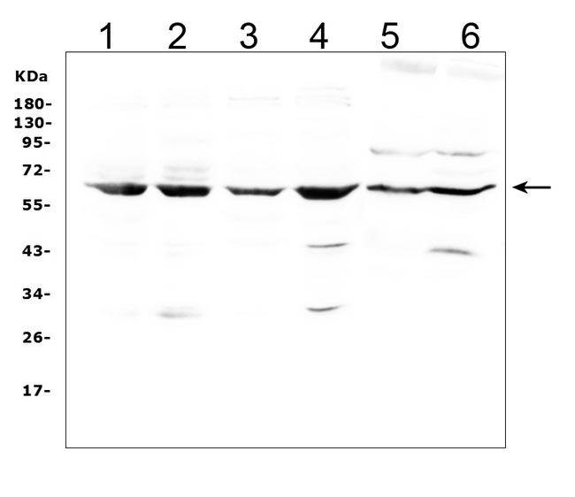 LBP Antibody - Western blot analysis of LBP using anti-LBP antibody. Electrophoresis was performed on a 5-20% SDS-PAGE gel at 70V (Stacking gel) / 90V (Resolving gel) for 2-3 hours. The sample well of each lane was loaded with 50ug of sample under reducing conditions. Lane 1: human Hela whole cell lysates, Lane 2: human Jurkat whole cell lysates, Lane 3: human A549 whole cell lysates, Lane 4: human Raji whole cell lysates, Lane 5: rat liver tissue lysates, Lane 6: mouse liver tissue lysates. After Electrophoresis, proteins were transferred to a Nitrocellulose membrane at 150mA for 50-90 minutes. Blocked the membrane with 5% Non-fat Milk/ TBS for 1.5 hour at RT. The membrane was incubated with rabbit anti-LBP antigen affinity purified polyclonal antibody at 0.5 µg/mL overnight at 4°C, then washed with TBS-0.1% Tween 3 times with 5 minutes each and probed with a goat anti-rabbit IgG-HRP secondary antibody at a dilution of 1:10000 for 1.5 hour at RT. The signal is developed using an Enhanced Chemiluminescent detection (ECL) kit with Tanon 5200 system. A specific band was detected for LBP at approximately 65KD. The expected band size for LBP is at 53KD.