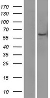 LBP Protein - Western validation with an anti-DDK antibody * L: Control HEK293 lysate R: Over-expression lysate