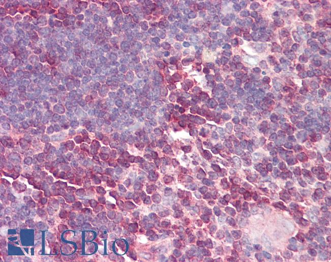 LBR / Lamin B Receptor Antibody - Anti-LBR / Lamin B Receptor antibody IHC of human thymus. Immunohistochemistry of formalin-fixed, paraffin-embedded tissue after heat-induced antigen retrieval. Antibody dilution 5-10 ug/ml. This image was taken for the unconjugated form of this product. Other forms have not been tested.