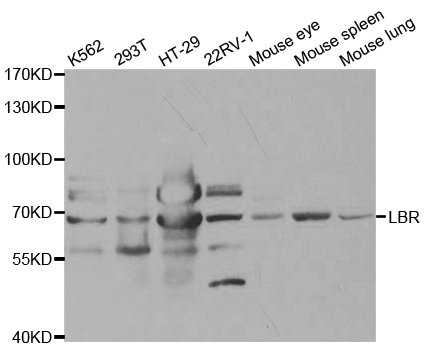 LBR / Lamin B Receptor Antibody - Western blot analysis of extracts of various cell lines.