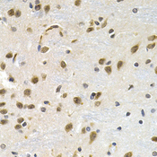 LBR / Lamin B Receptor Antibody - Immunohistochemistry of paraffin-embedded rat brain tissue.