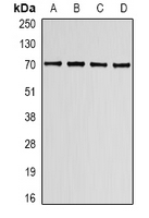 LBR / Lamin B Receptor Antibody - Western blot analysis of Lamin B Receptor expression in K562 (A); HT29 (B); mouse spleen (C); mouse lung (D) whole cell lysates.