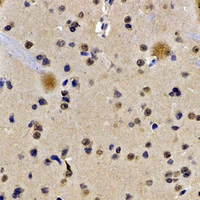 LBR / Lamin B Receptor Antibody - Immunohistochemical analysis of Lamin B Receptor staining in rat brain formalin fixed paraffin embedded tissue section. The section was pre-treated using heat mediated antigen retrieval with sodium citrate buffer (pH 6.0). The section was then incubated with the antibody at room temperature and detected using an HRP conjugated compact polymer system. DAB was used as the chromogen. The section was then counterstained with hematoxylin and mounted with DPX.