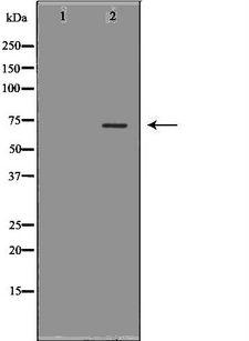 LBR / Lamin B Receptor Antibody - Western blot analysis of HeLa whole cells lysates using LBR antibody. The lane on the left is treated with the antigen-specific peptide.