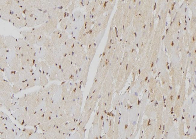 LBR / Lamin B Receptor Antibody - 1:100 staining mouse heart tissue by IHC-P. The sample was formaldehyde fixed and a heat mediated antigen retrieval step in citrate buffer was performed. The sample was then blocked and incubated with the antibody for 1.5 hours at 22°C. An HRP conjugated goat anti-rabbit antibody was used as the secondary.