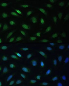 LBR / Lamin B Receptor Antibody - Immunofluorescence analysis of U-2OS cells using LBR Polyclonal Antibody at dilution of 1:100 (40x lens).Blue: DAPI for nuclear staining.