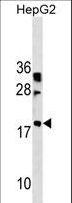LBX2 Antibody - LBX2 Antibody western blot of HepG2 cell line lysates (35 ug/lane). The LBX2 antibody detected the LBX2 protein (arrow).