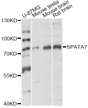 LCA3 / SPATA7 Antibody - Western blot analysis of extracts of various cell lines, using SPATA7 antibody at 1:3000 dilution. The secondary antibody used was an HRP Goat Anti-Rabbit IgG (H+L) at 1:10000 dilution. Lysates were loaded 25ug per lane and 3% nonfat dry milk in TBST was used for blocking. An ECL Kit was used for detection and the exposure time was 10s.