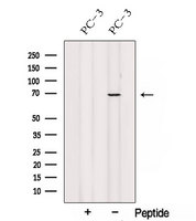 LCA3 / SPATA7 Antibody - Western blot analysis of extracts of PC-3 cells using SPATA7 antibody. The lane on the left was treated with blocking peptide.