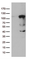 LCA5 Antibody - HEK293T cells were transfected with the pCMV6-ENTRY control. (Left lane) or pCMV6-ENTRY LCA5. (Right lane) cDNA for 48 hrs and lysed. Equivalent amounts of cell lysates. (5 ug per lane) were separated by SDS-PAGE and immunoblotted with anti-LCA5. (1:500)