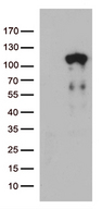 LCA5 Antibody - HEK293T cells were transfected with the pCMV6-ENTRY control. (Left lane) or pCMV6-ENTRY LCA5. (Right lane) cDNA for 48 hrs and lysed. Equivalent amounts of cell lysates. (5 ug per lane) were separated by SDS-PAGE and immunoblotted with anti-LCA5. (1:500)